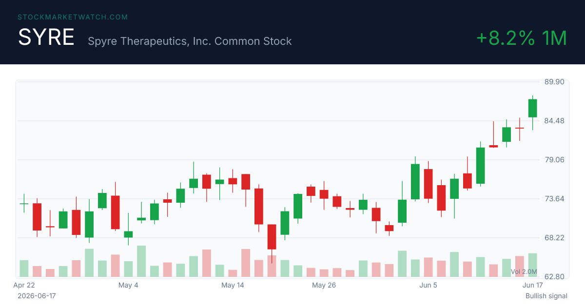 RXT chart